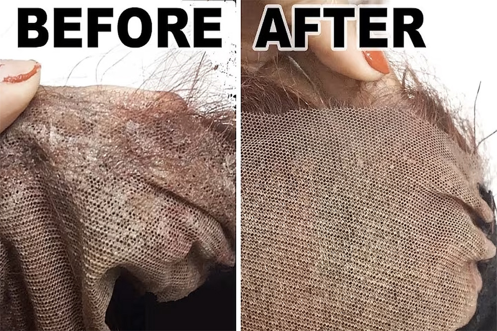 Crystal‑Clear Lace: The Ultimate Guide to Effortless Glue Removal for Pristine Wigs